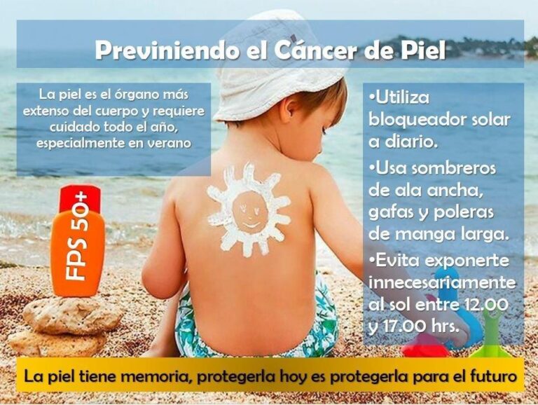 ¿Cómo se puede prevenir el cáncer de piel? - Sevilla Información
